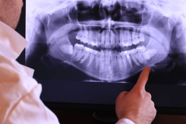 Best Pediatric Emergency Dentist in Bakerstown, PA